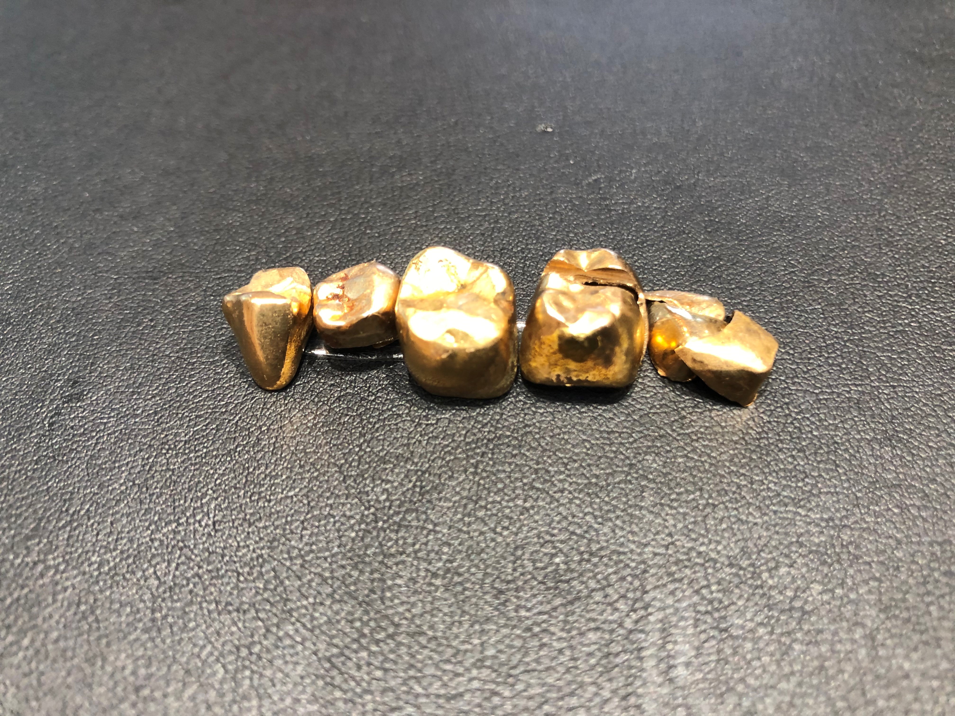 金 18k 10k 金歯 ツブシ まとめ売り IMG-0187.jpg